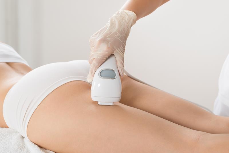 Laser Hair Removal